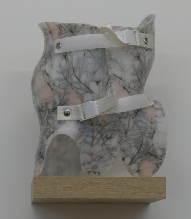 AOP - Atelier prothésiste orthèse et prothèse