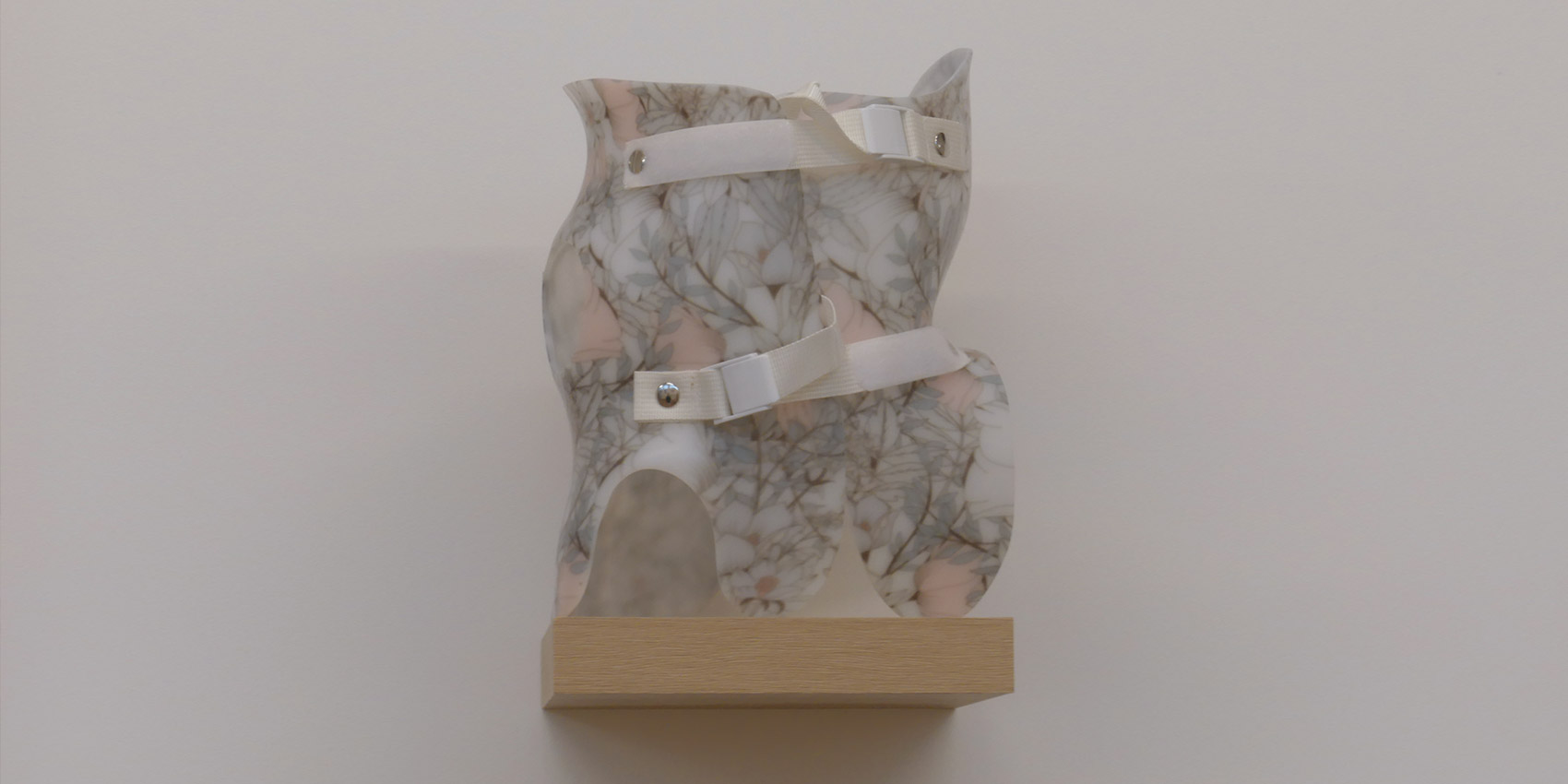 AOP - Atelier prothésiste orthèse pour traitement de la scoliose