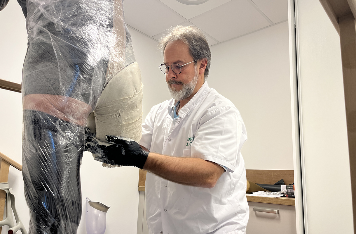 AOP - Moulage du moignon à la cuisse pour prothèse de jambe
