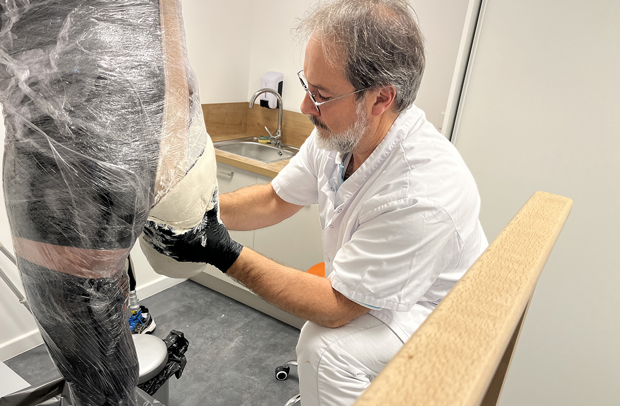 AOP - Moulage du moignon à la cuisse pour prothèse de jambe